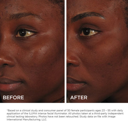 ILUMA Illuminateur Visage Intense 30ml